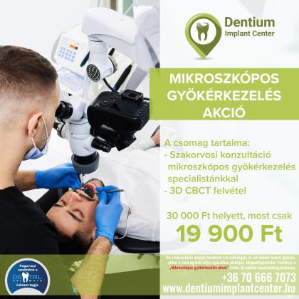 Mikroszkópos gyökérkezelés akció Mikroszkópos gyökérkezelés akció